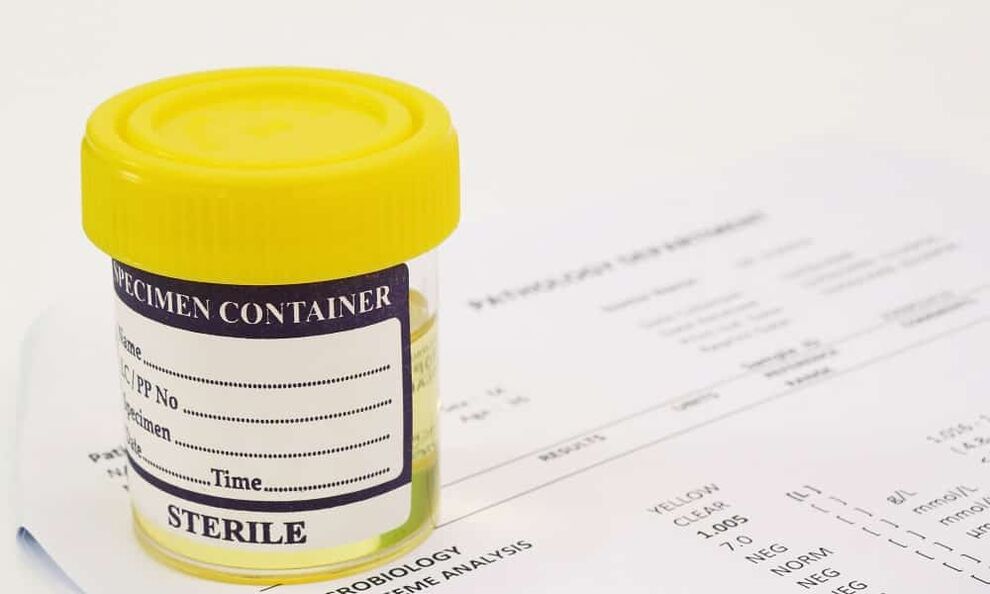 Pred užitím antibiotík musíte absolvovať vyšetrenie moču